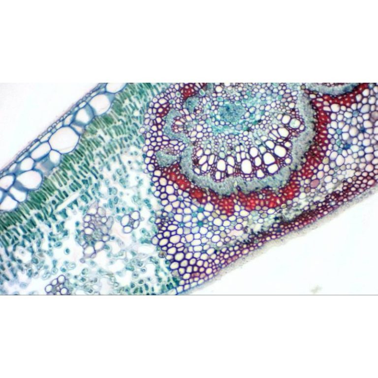 Bresser Mikrocular Full HD Κάμερα Προσοφθάλμιου Φακού