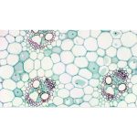 Bresser Mikrocular Full HD Κάμερα Προσοφθάλμιου Φακού