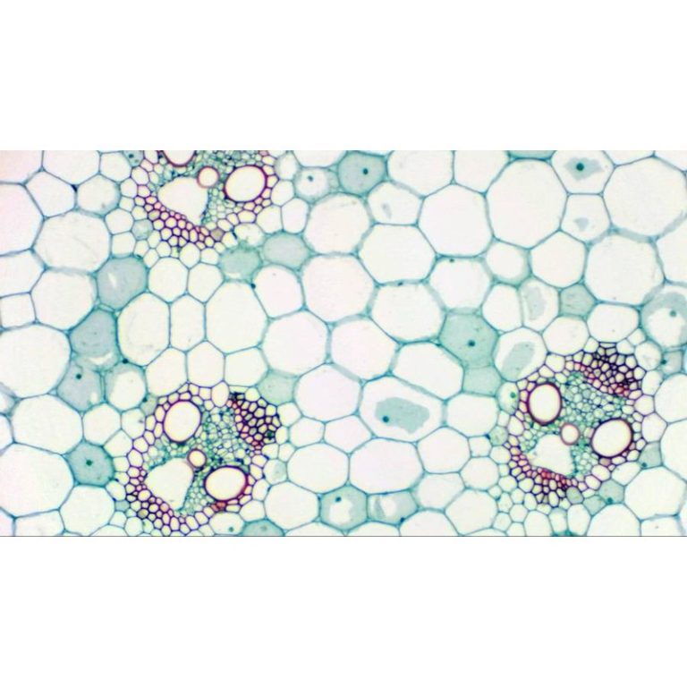 Bresser Mikrocular Full HD Κάμερα Προσοφθάλμιου Φακού